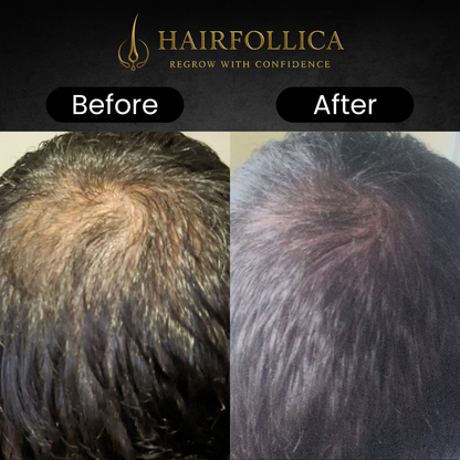 Hairfollica Foam 2.0